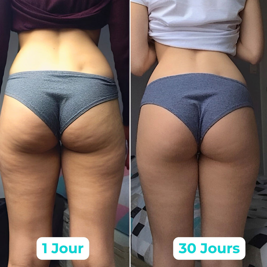 Vibraskin® - Améliore l'apparence de la peau